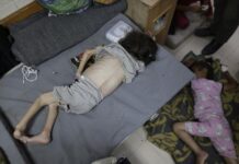 Derita 50 Ribu Anak Kurang Gizi di Gaza