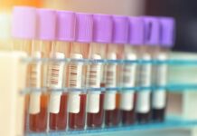 Kenapa Penamaan Virus Mpox Pakai Istilah ‘Clade’? Ini Penjelasan Ilmiahnya