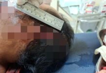 Sengketa Tanah Warisan, Warga Lombok Ditebas Parang oleh Saudaranya